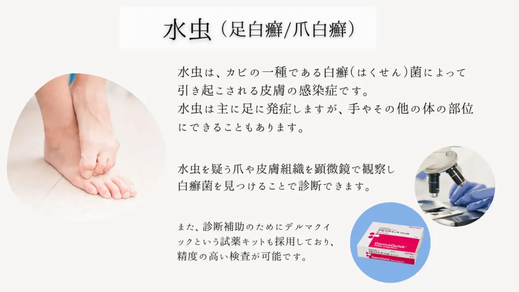 水虫
