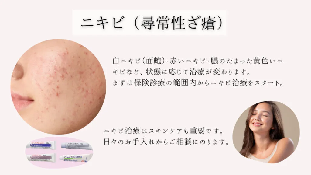 ニキビ
