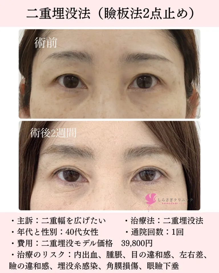 40代女性二重
