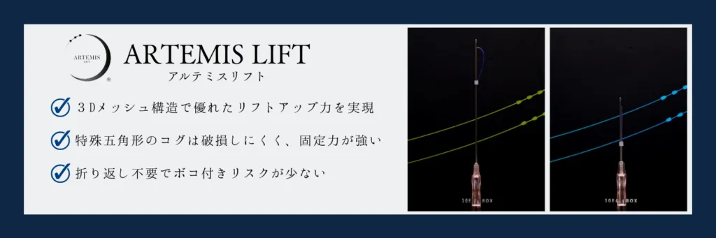 アルテミスリフトとは