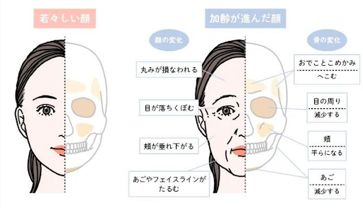 骨が減少するとどうなるのか？