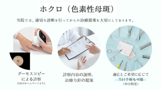 ほくろ