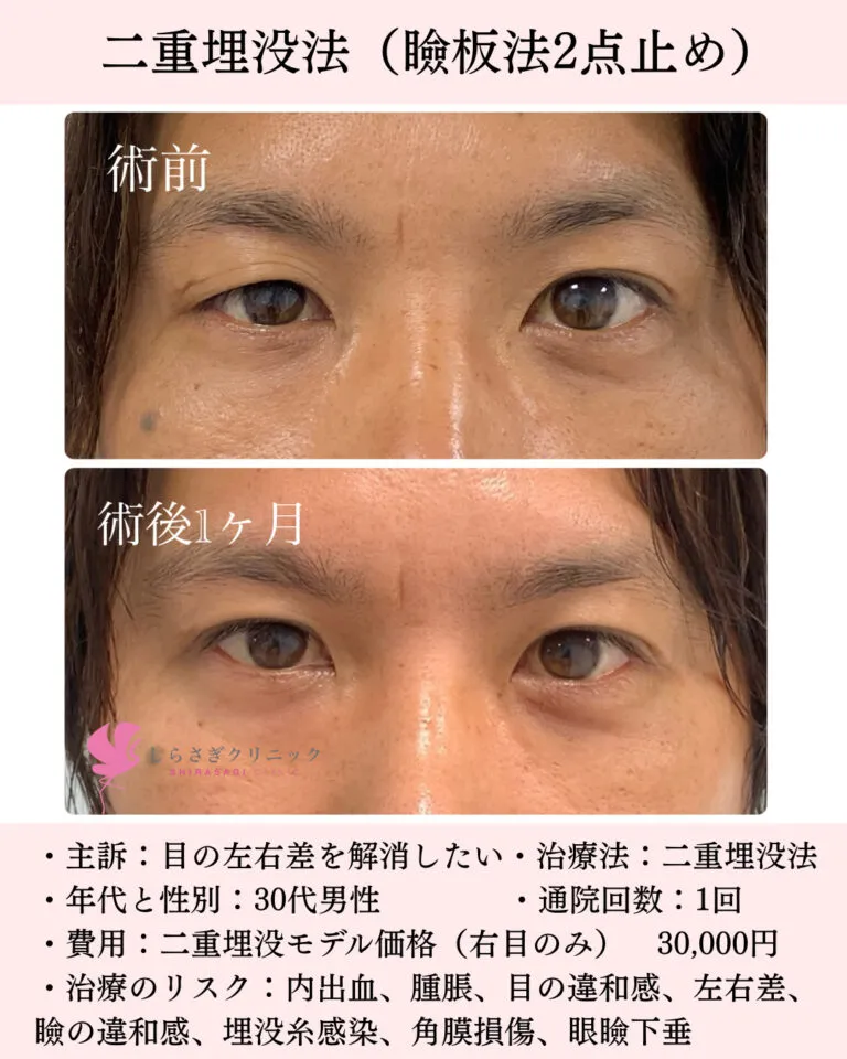 二重男性